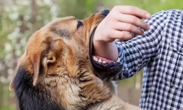 Trẻ 3 tuổi tử vong thương tâm do chó dại cắn, cần tăng cường biện pháp phòng tránh