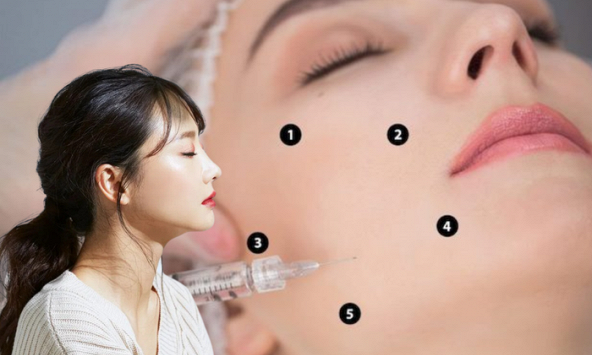 Những điều cần biết về tiêm BAP đang làm mưa làm gió mùa hè này