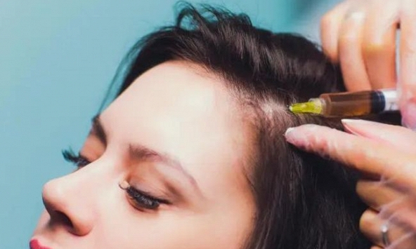 Tạm biệt nỗi lo rụng tóc với liệu pháp mesotherapy