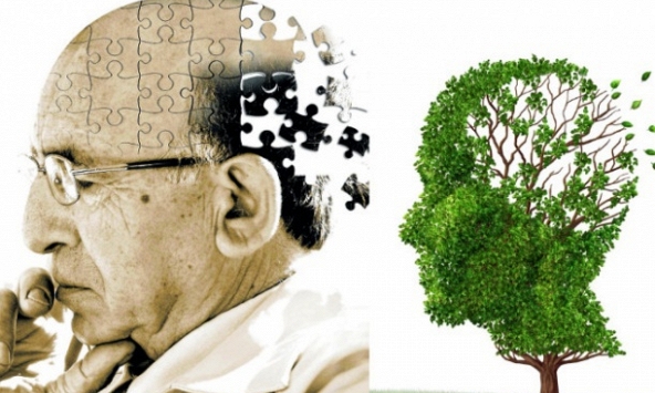Mỹ yêu cầu dữ liệu bệnh nhân để thanh toán chi phí cho loại thuốc mới điều trị Alzheimer