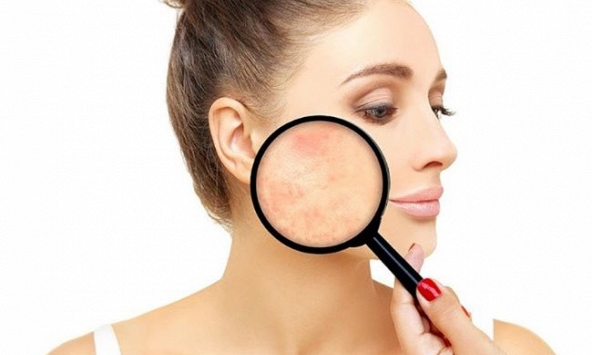 Skin Microbiome - Xu hướng mới của ngành mỹ phẩm chăm sóc da