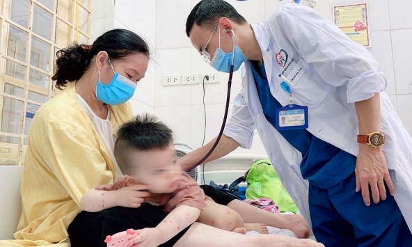 Bộ Y tế yêu cầu rà soát thiết bị, thuốc để tiếp nhận các ca tay chân miệng nặng