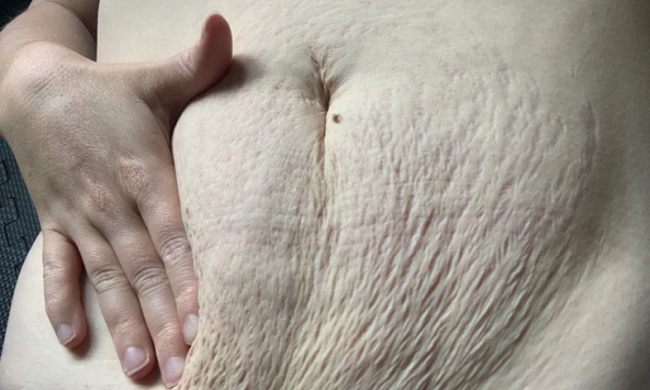 8 dấu hiệu thay đổi của cơ thể khi mang thai, mẹ bầu nên biết