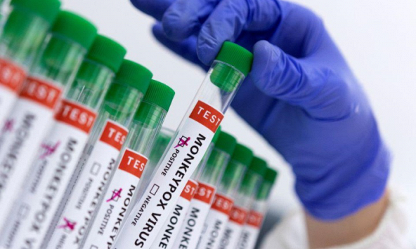 Số ca mắc đậu mùa khỉ tăng đột biến ở thanh thiếu niên Thái Lan