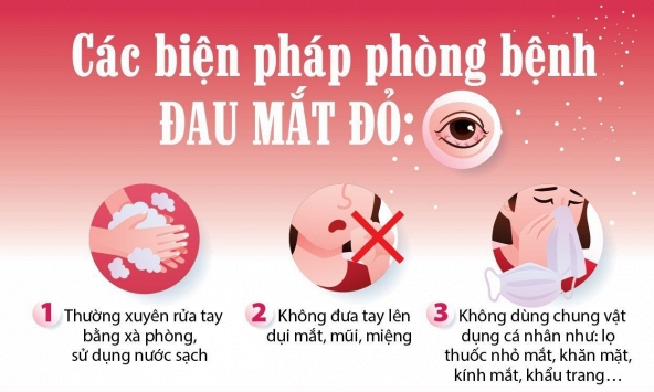 Bệnh đau mắt đỏ đang gia tăng, cần làm gì để phòng bệnh?