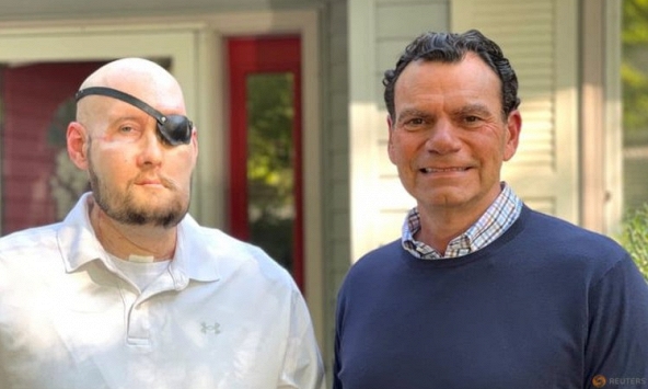 Các bác sĩ Mỹ thực hiện ca ghép mắt đầu tiên trên thế giới