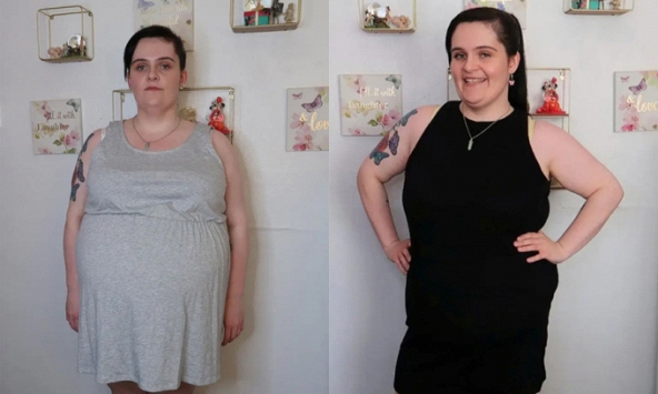 Tưởng mang thai, người phụ nữ không ngờ mình bị u nang buồng trứng nặng 16kg