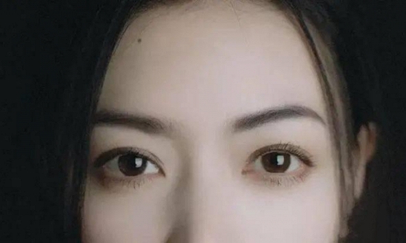 Nốt ruồi ở 4 vị trí này trên mặt ảnh hưởng nhiều đến sự nghiệp mà chẳng mấy người biết, vị trí số 3 hao hụt tài lộc thấy rõ