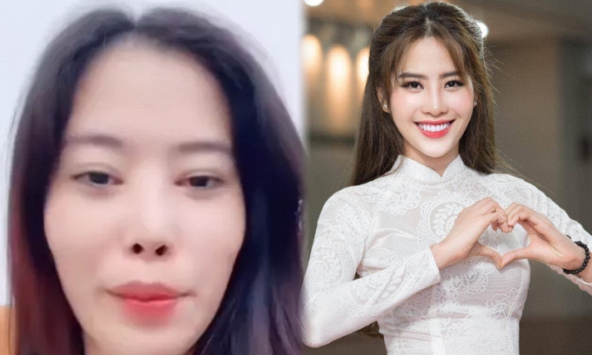 Thẩm mỹ lỗi chi tiết nào trên gương mặt mà khiến Nam Em ngày càng khác lạ và lời khuyên của chuyên gia khi làm đẹp