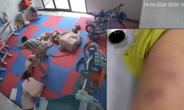 Xôn xao clip bé gái bị đứa trẻ 6 tuổi nhà hàng xóm đánh tím người, nhiều phụ huynh bàng hoàng, thắc mắc về cách giáo dục con