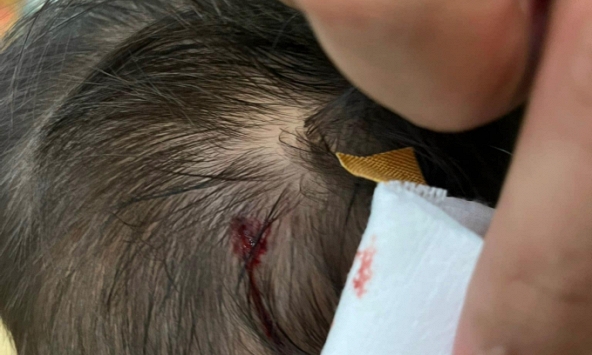 Bà mẹ Hà Nội tố giáo viên thiếu trách nhiệm khiến con bị chảy máu đầu, nhìn mốc thời gian, nhiều người khó hiểu