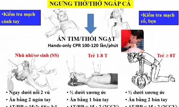 Bệnh viện Nhi đồng Thành phố: Cách sơ cứu đúng cách khi trẻ đuối nước