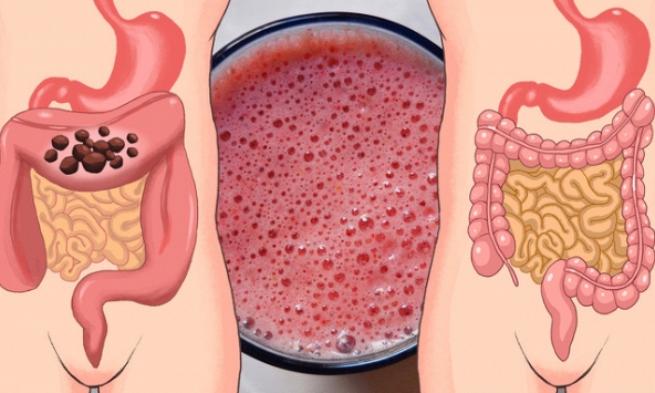 7 cách đơn giản giúp làm sạch ruột già mà không tốn kém