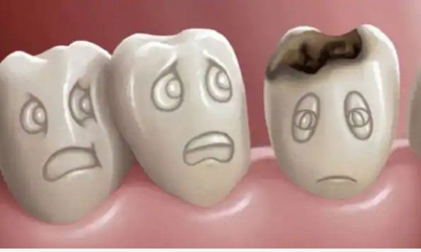 Việc tái tạo men răng trở nên dễ dàng hơn với gel tái khoáng hóa men răng