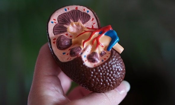 5 cách tự nhiên để ngăn ngừa tình trạng sỏi thận
