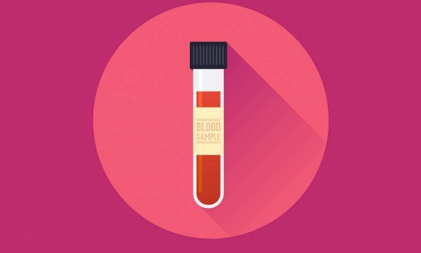 90% phụ nữ mắc ung thư buồng trứng có thể sống sót nhờ vào kỹ thuật xét nghiệm mới này
