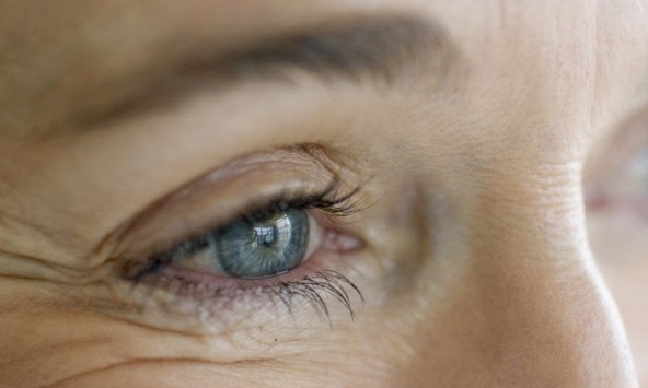 Tại sao vết chân chim lại xuất hiện ở đuôi mắt? 