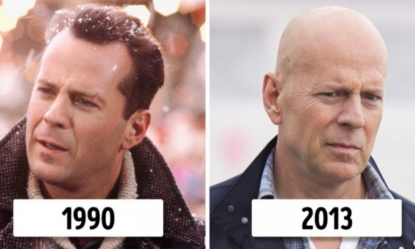 Làm việc hơn 52 giờ mỗi tuần có khả năng hói đầu cao
