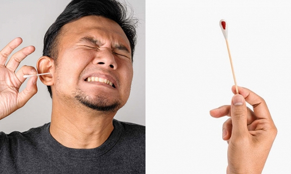 Màu sắc ráy tai nói lên tình trạng sức khỏe của bạn?