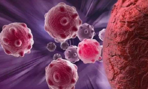 Ngày Ung thư thế giới 4/2: Cách đối phó với tác dụng phụ của xạ trị