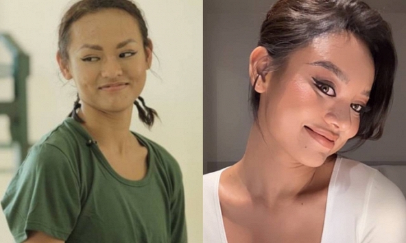 Á hậu Mai Ngô nghi vấn phẫu thuật thẩm mỹ