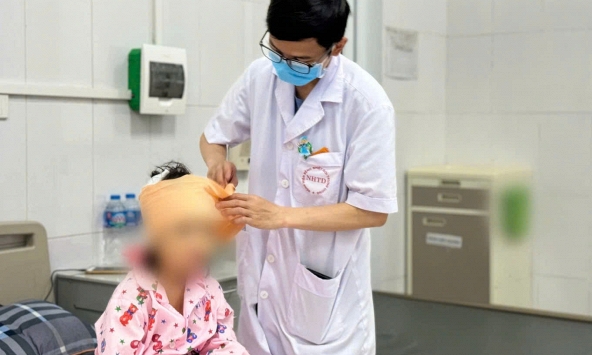 Bị chó cắn: Cách xử lý khẩn cấp cha mẹ cần biết để phòng bệnh dại