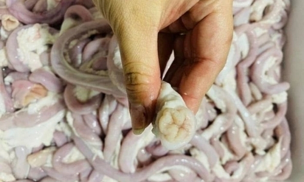 Người phụ nữ 73 tuổi nguy kịch vì liên cầu khuẩn lợn sau khi bán lòng lợn tại nhà