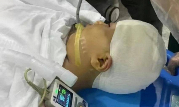 Nữ sinh lớp 4 bị thầy giáo dùng thước 'tác động vật lý' đến mức vỡ hộp sọ, thái độ của 'hung thủ' sau đó càng gây phẫn nộ hơn