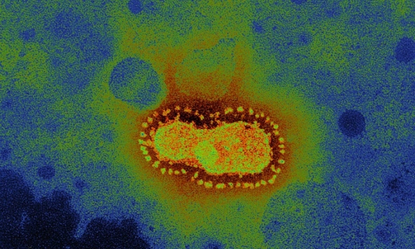 Coronavirus - 'Nỗi sợ của những điều chưa biết' và những tia sáng hi vọng