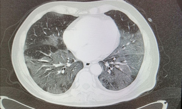 Bức thư đau đớn của bác sỹ người Ý giữa tâm dịch Covid-19