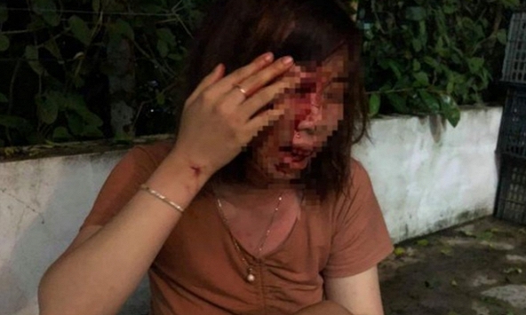 Người phụ nữ mang thai 4 tháng bị hàng xóm đánh trọng thương vì... đường lầy lội