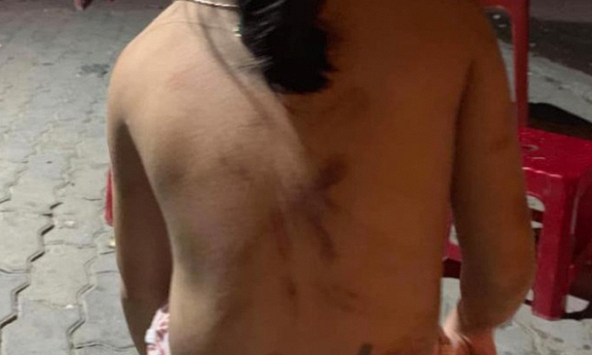 Cháu bé bị bà cố nội đánh đập  dã man 