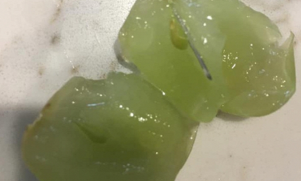 Thêm vụ phát hiện kim nhọn trong trái cây