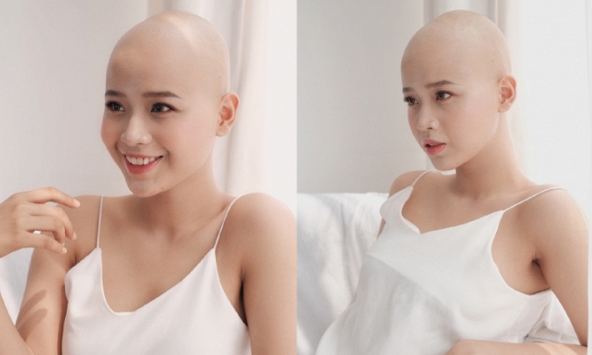 Hành trình chiến đấu với bệnh ung thư của nữ sinh 20 tuổi ĐH Ngoại thương