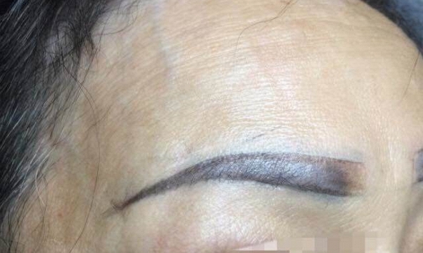 Người phụ nữ hôn mê sau khi xăm chân mày đã tử vong