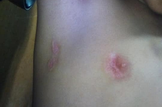 Mẹ ruột và nhân tình bị bắt vì nghi bạo hành bé gái dã man