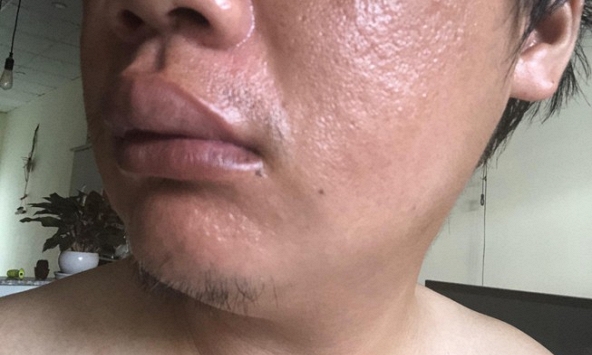 TPHCM: Một phóng viên bị hành hung khi đang đậu xe trước cửa... nhà mình