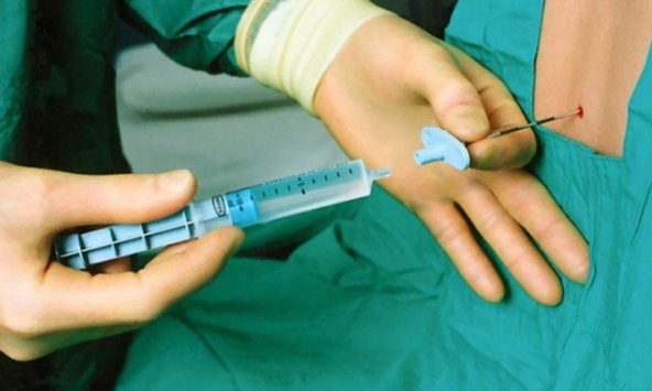 2 sản phụ tử vong tại bệnh viện Phụ nữ Đà Nẵng nghi do liên quan thuốc gây tê