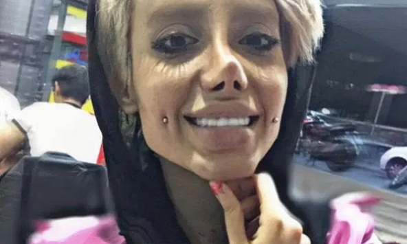 Phiên bản lỗi của Angelina Jolie và những trải lòng sau 50 cuộc phẫu thuật thẩm mỹ