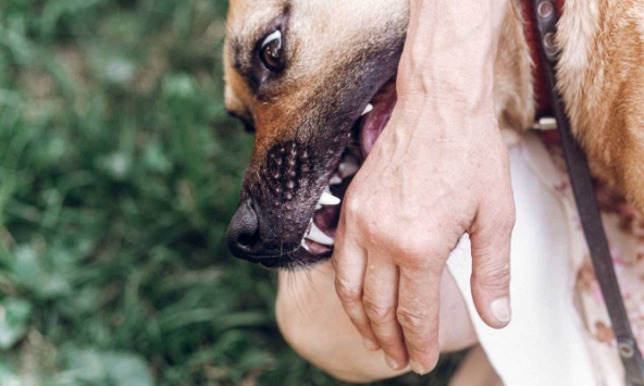 Hãi hùng trẻ bị chó cưng cắn