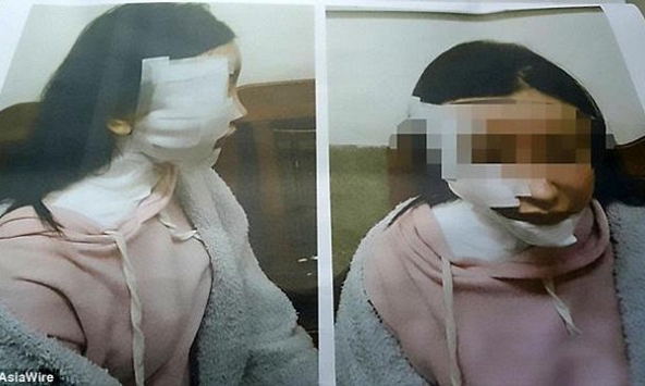    Trong men say chồng hắt nước sôi vào mặt vợ