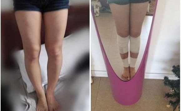 Có thể mất mạng vì kéo chân 'sửa lỗi tạo hóa'