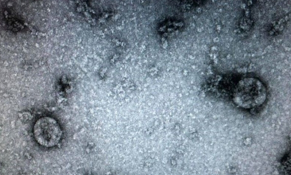 Việt Nam đã nuôi cấy và phân lập thành công virus corona mới