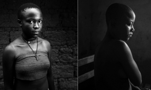 Bàng hoàng những người mẹ dùng chày nung nóng để ủi ngực con gái vì lo sợ quấy rối tình dục