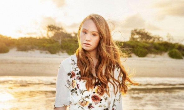 Người mẫu mắc hội chứng Down đầu tiên trên thế giới không được ký hợp đồng với công ty quản lý