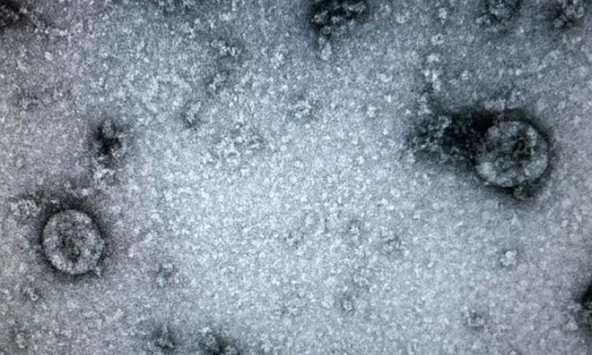 Virus gây ra dịch Covid-19 ở Việt Nam đã có tiến hóa