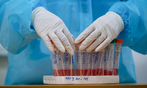 Đã có 30 người đăng ký hiến phổi cứu bệnh nhân phi công người Anh