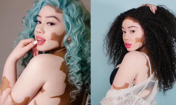 Nữ người mẫu từng bị ví như 'bò sữa' ngày càng nổi tiếng