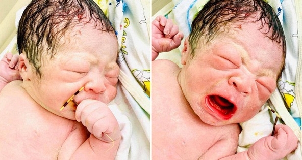 Sự thật về bức ảnh bé sơ sinh chào đời cầm vòng tránh thai gây xôn xao MXH