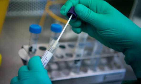 Bộ Y tế lý giải vì sao bệnh nhân người Indonesia dương tính rồi lại âm tính với covid-19